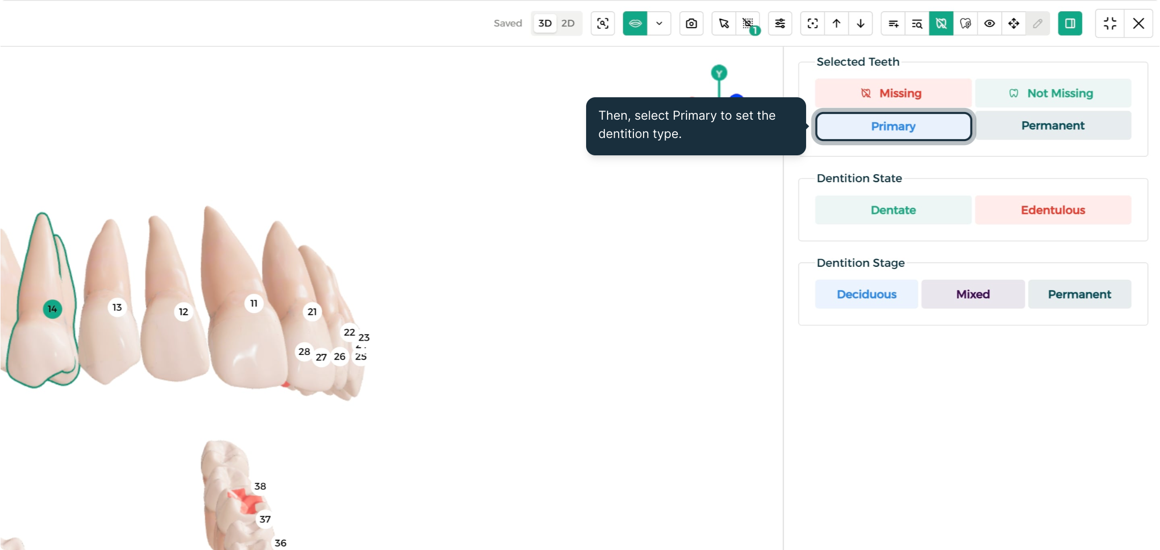 Step 3 - Set dentition type to Primary